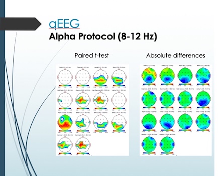 005 le groupe alpha