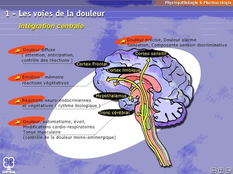 009 La matrice de la douleur