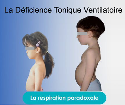 la déficience tonique ventilatoire enfant TDAH